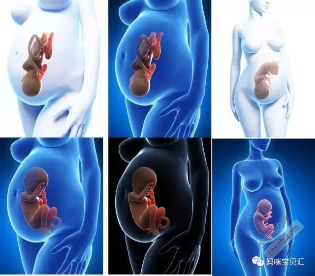 「独家」孕囊形状可以看男女？孕妈们都讨论疯了，靠谱吗？