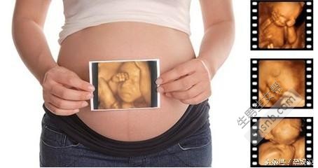 婆婆教了一招看男女，通过四维彩超 孕囊数据看，好简单
