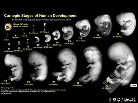 婆婆教了一招看男女，通过四维彩超 孕囊数据看，好简单
