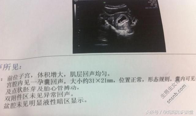 孕囊看男女准不准？据说99.9%的孕妈都试过