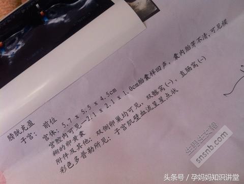 孕囊看男女准不准？据说99.9%的孕妈都试过