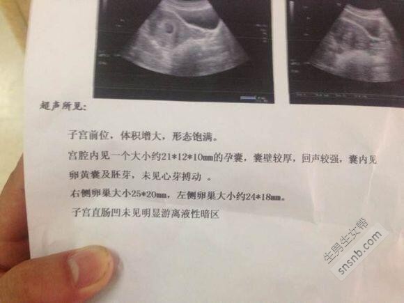 怀孕40天孕囊大小正常是多少