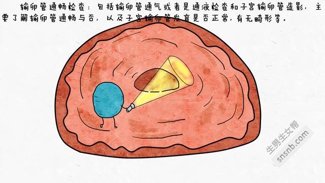 迟迟不孕难道是得了多囊卵巢？女性不孕该怎么鉴别？