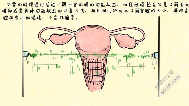迟迟不孕难道是得了多囊卵巢？女性不孕该怎么鉴别？