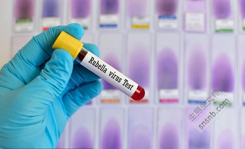 福州风疹病毒检测一般多少钱