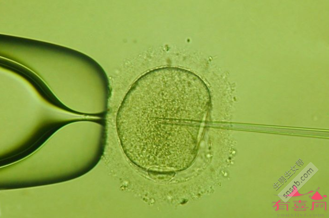 48岁做试管婴儿成功率高吗