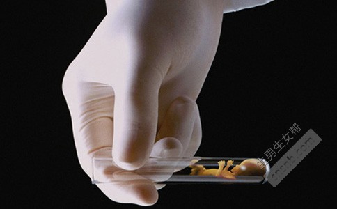 石家庄试管婴儿做一次多少钱