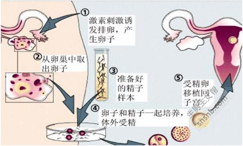 福州做一次试管婴儿多少钱